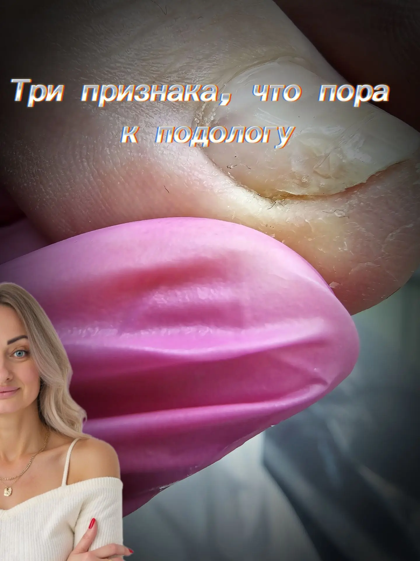 🥵Вросшие ногти,  скольким людям эта проблема доставляет дискомфорт,  боль и ограничения 🤦‍♀️
Когда