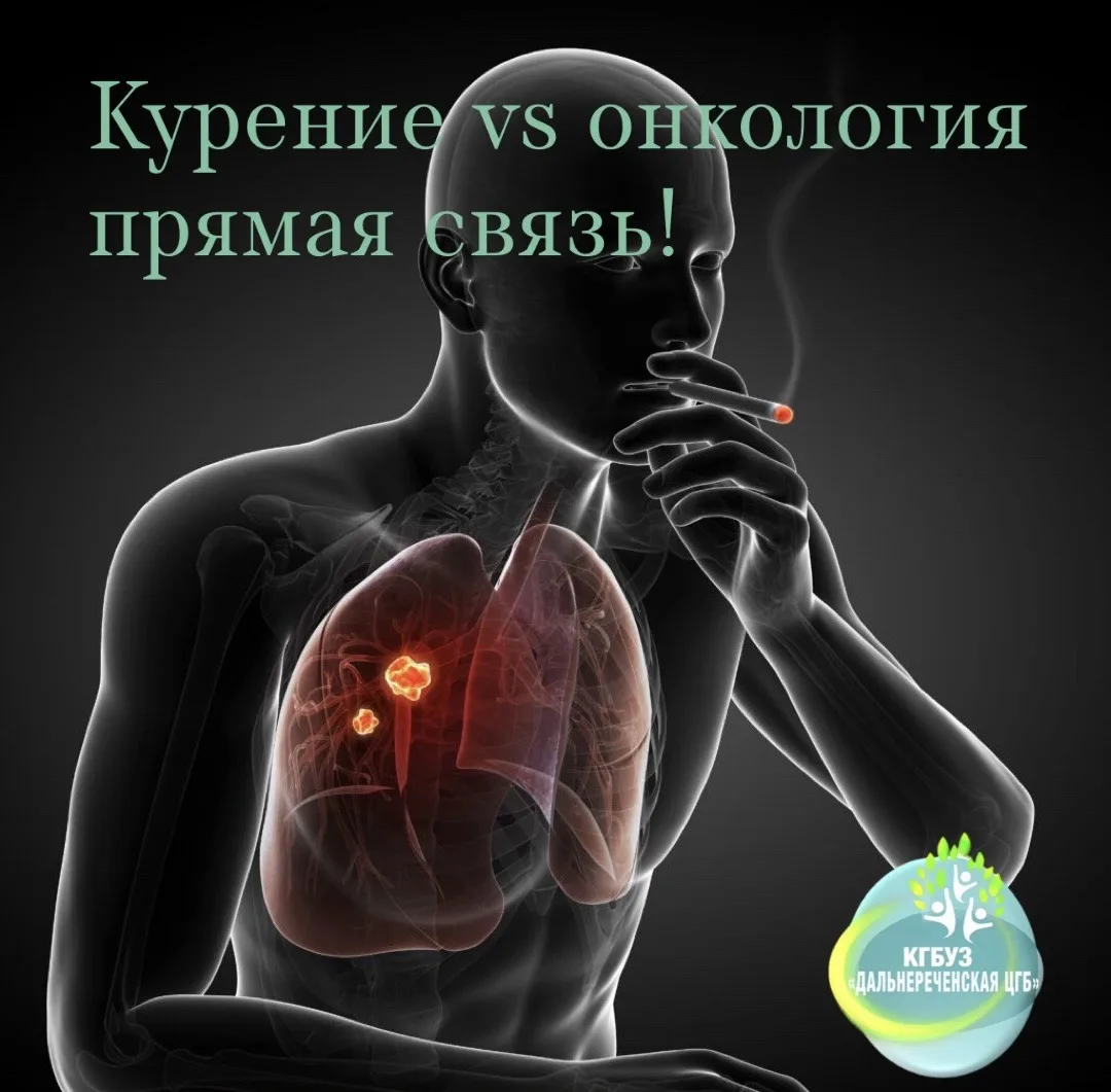 ✔️Между курением и развитием онкологических заболеваний существует доказанная прямая связь. Табачный