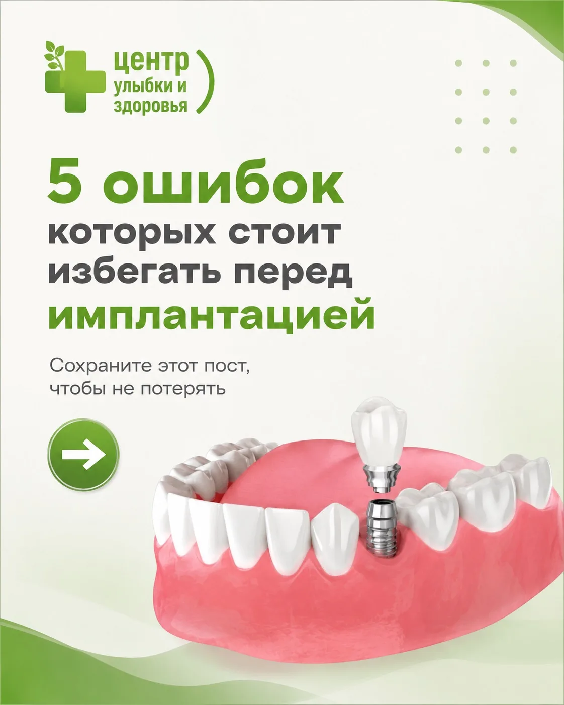 🦷 Планируете имплантацию зубов? Тогда обязательно сохраните этот пост.

В карточках выше мы собрали