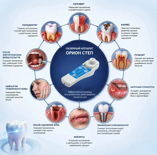 🦷 Поговорим о зубах? 🦷