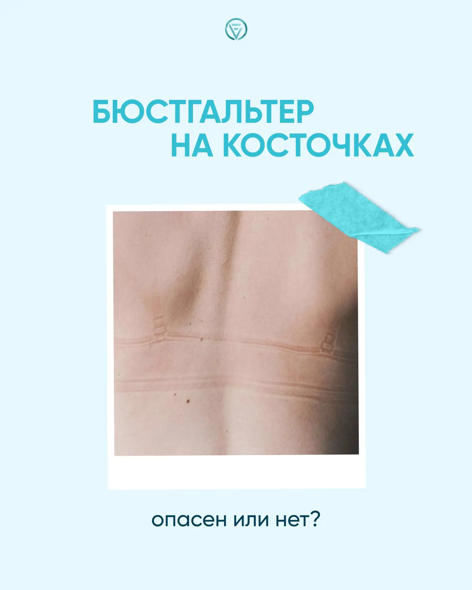 «Косточки пережимают лимфу и вызывают рак груди» — миф, который я слышу на приёме регул...
