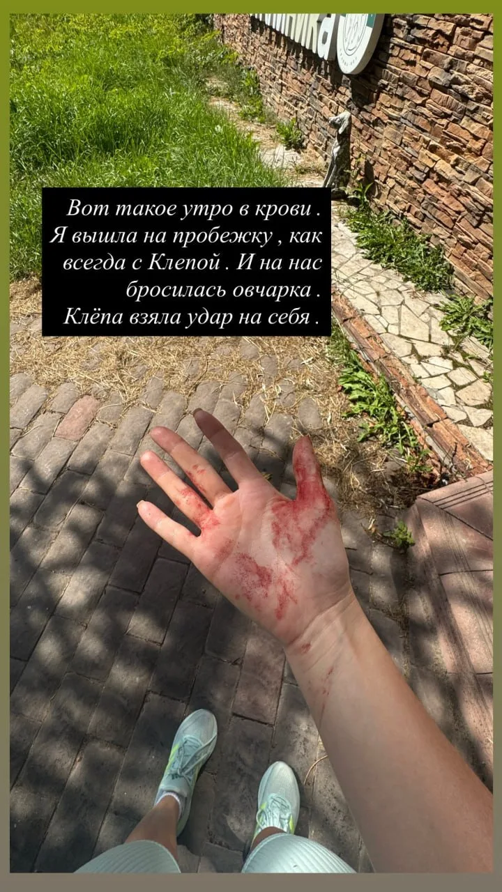 Питомец спас звезду «Уральских пельменей» Илану Дылдину от овчарки на Рублевке.
