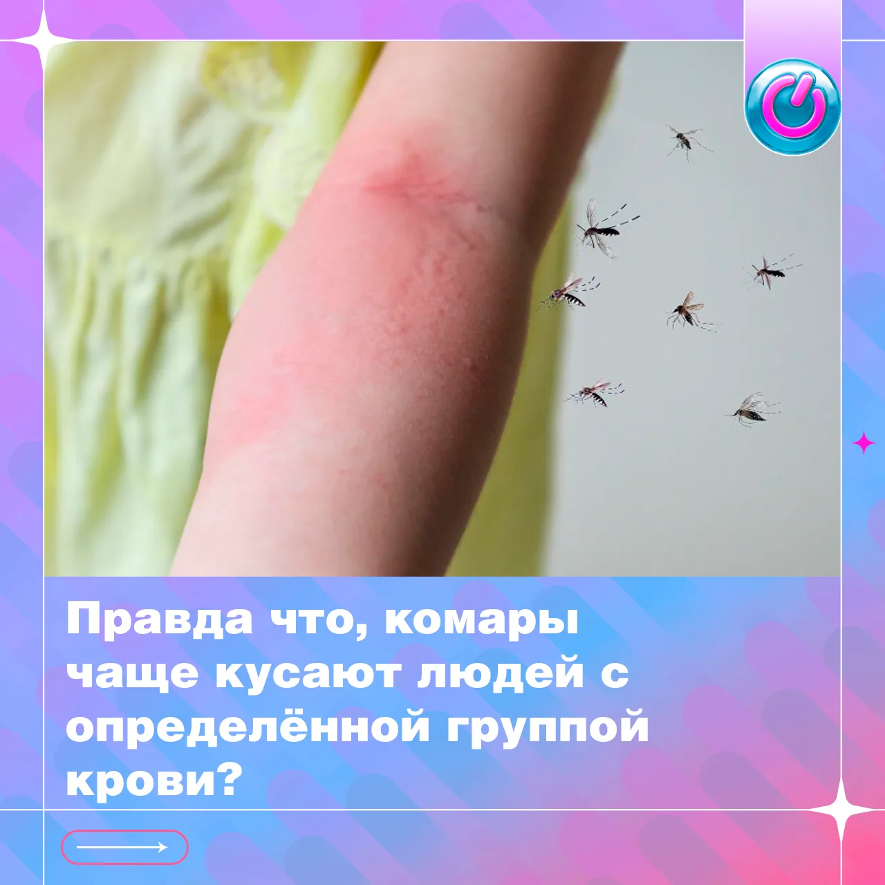 Вас тоже кусают комары чаще остальных? Нашли ответ, почему