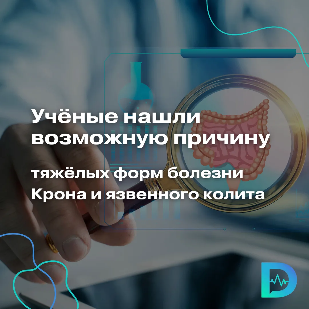 Учёные нашли возможную причину тяжёлых форм болезни Крона и язвенного колита

Воспалительные заболев