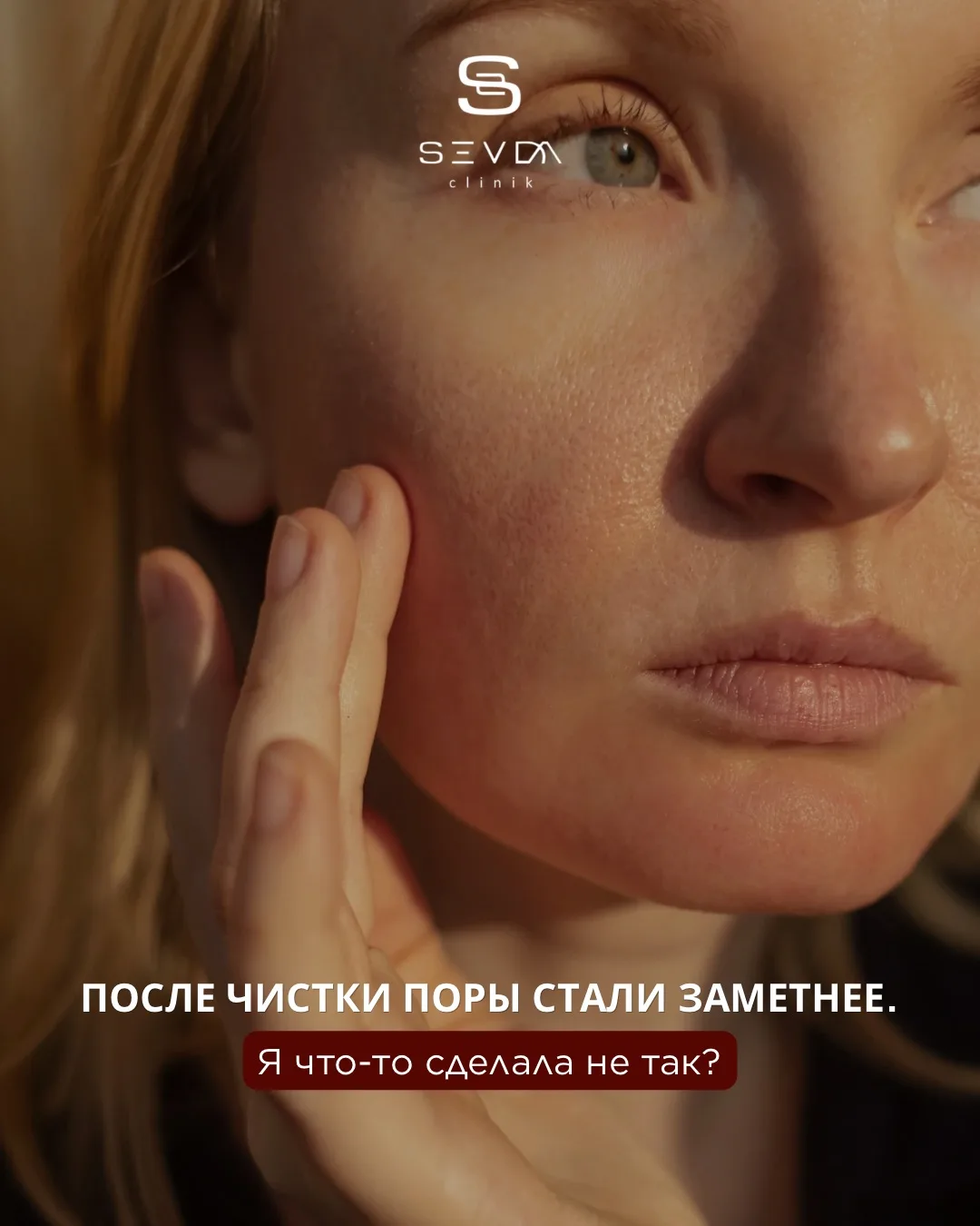 «После чистки поры стали заметнее. Я что-то сделала не так?»