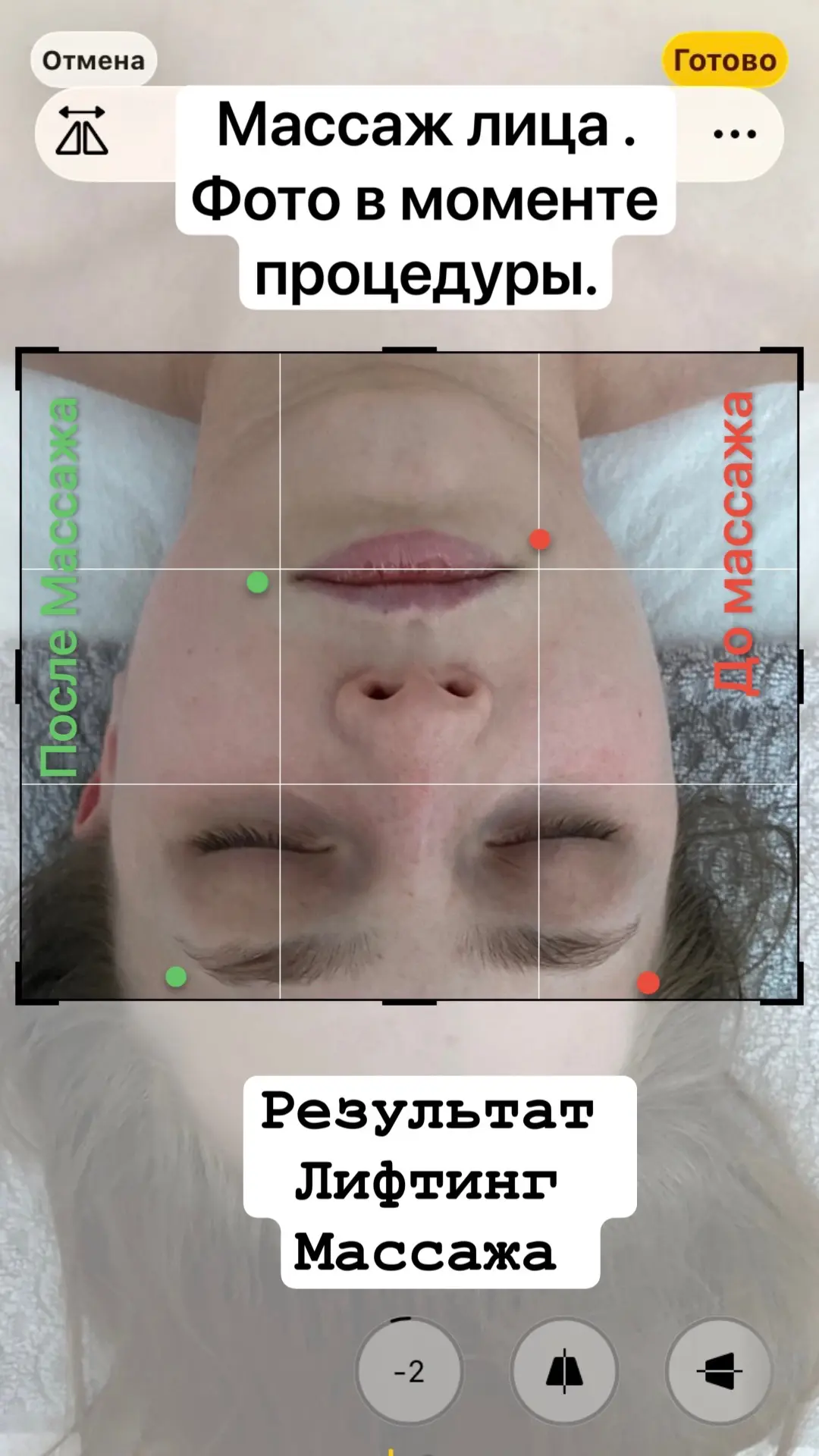 Результат Лифьинг массажа лица .