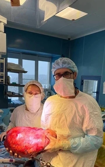 ❗️После родов живот не уменьшился. Онкологи удалили пациентке восьмикилограммовую опухоль

🤷‍♂️Опух