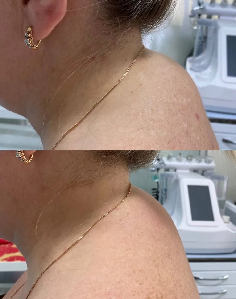 💆‍♀️ Когда работа — это тяжелый физический труд: начало преображения