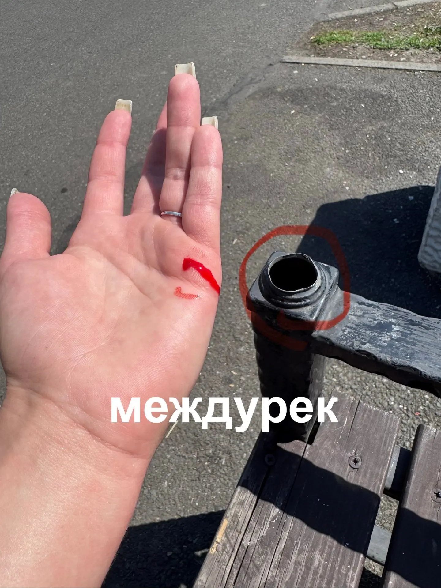 Здравствуйте! На дамбе многие лавочки вот в таком состояние сегодня я поранилась об эту железку, оче