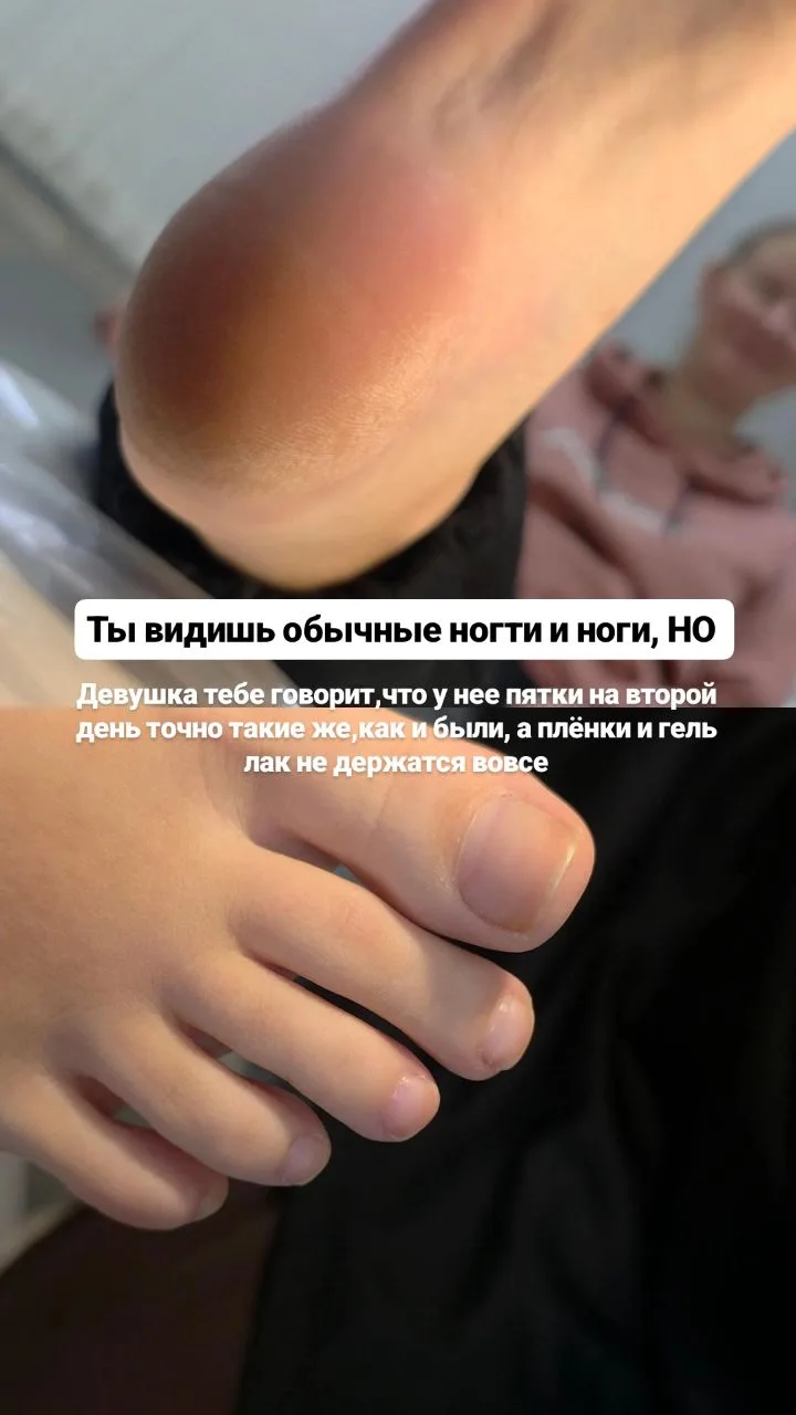 У этой клиентки педикюр не держался дольше двух дней.Покрытие быстро скалывалось, поэто...