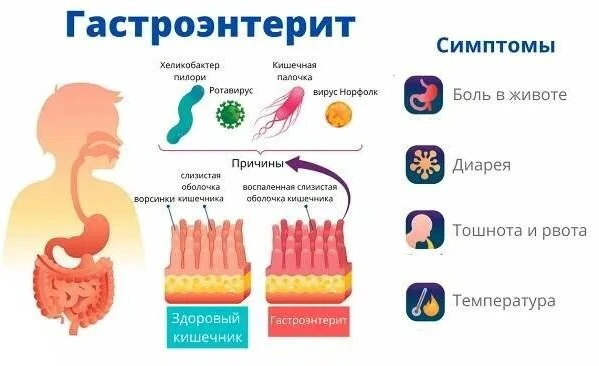 В Балашихе семь человек подхватили острый гастроэнтерит в реабилитационном центре. Инци...