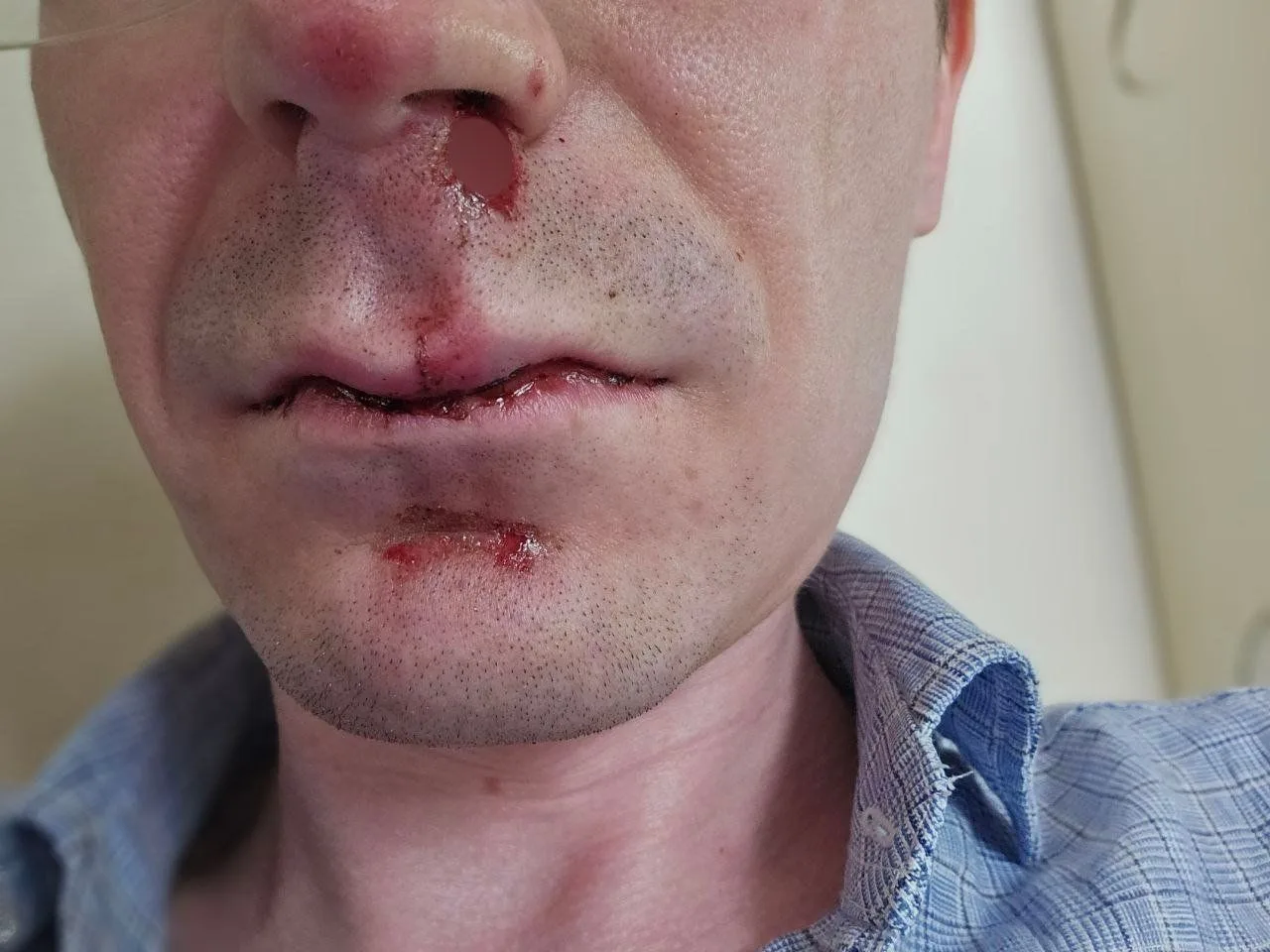 Банда подростков напала на двух мужчин в центре Перми сегодня утром.

Один из пострадавших написал а