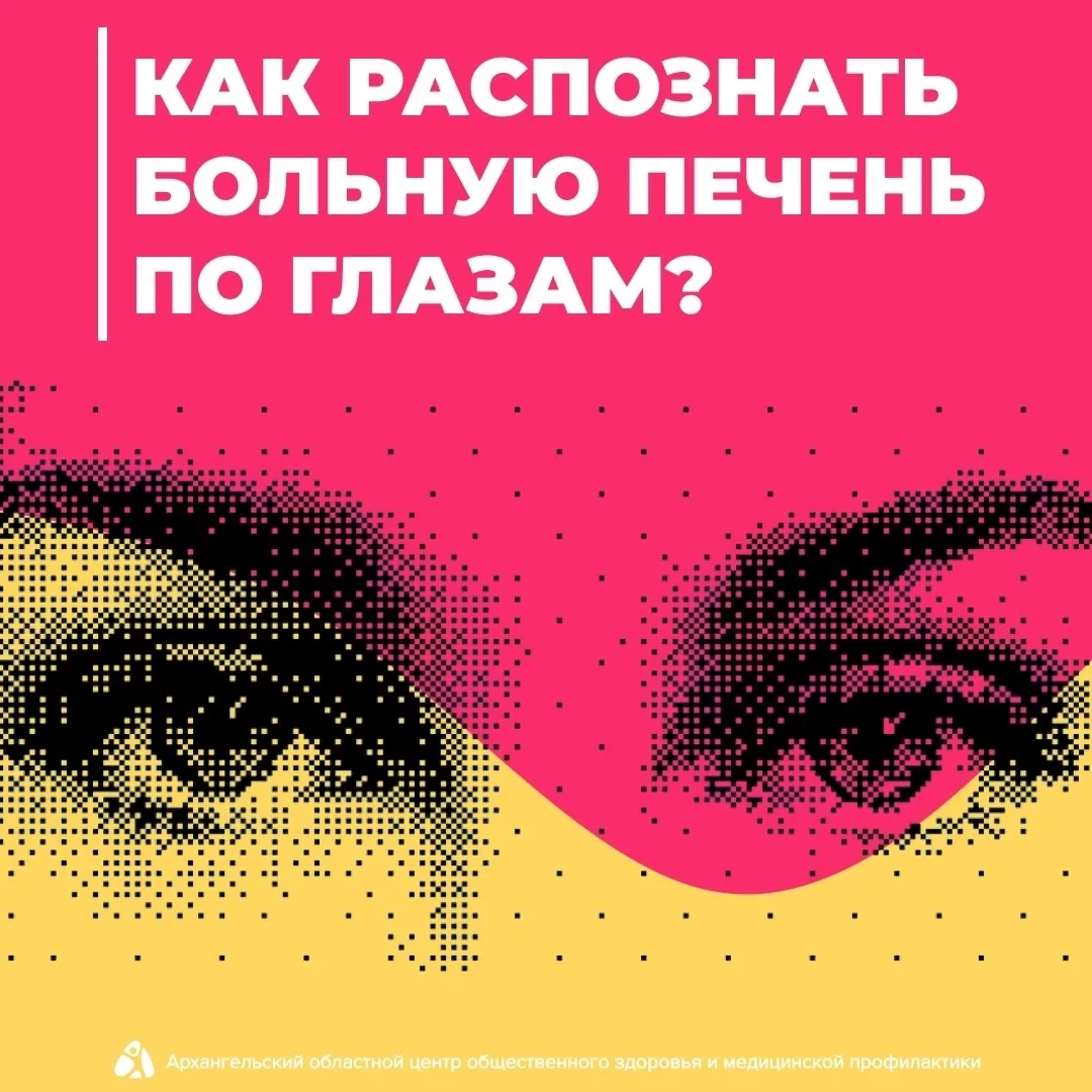 👀🤍 О чём могут рассказать ваши глаза? 
 
Глаза – не только зеркало души, но и индикатор здоровья п