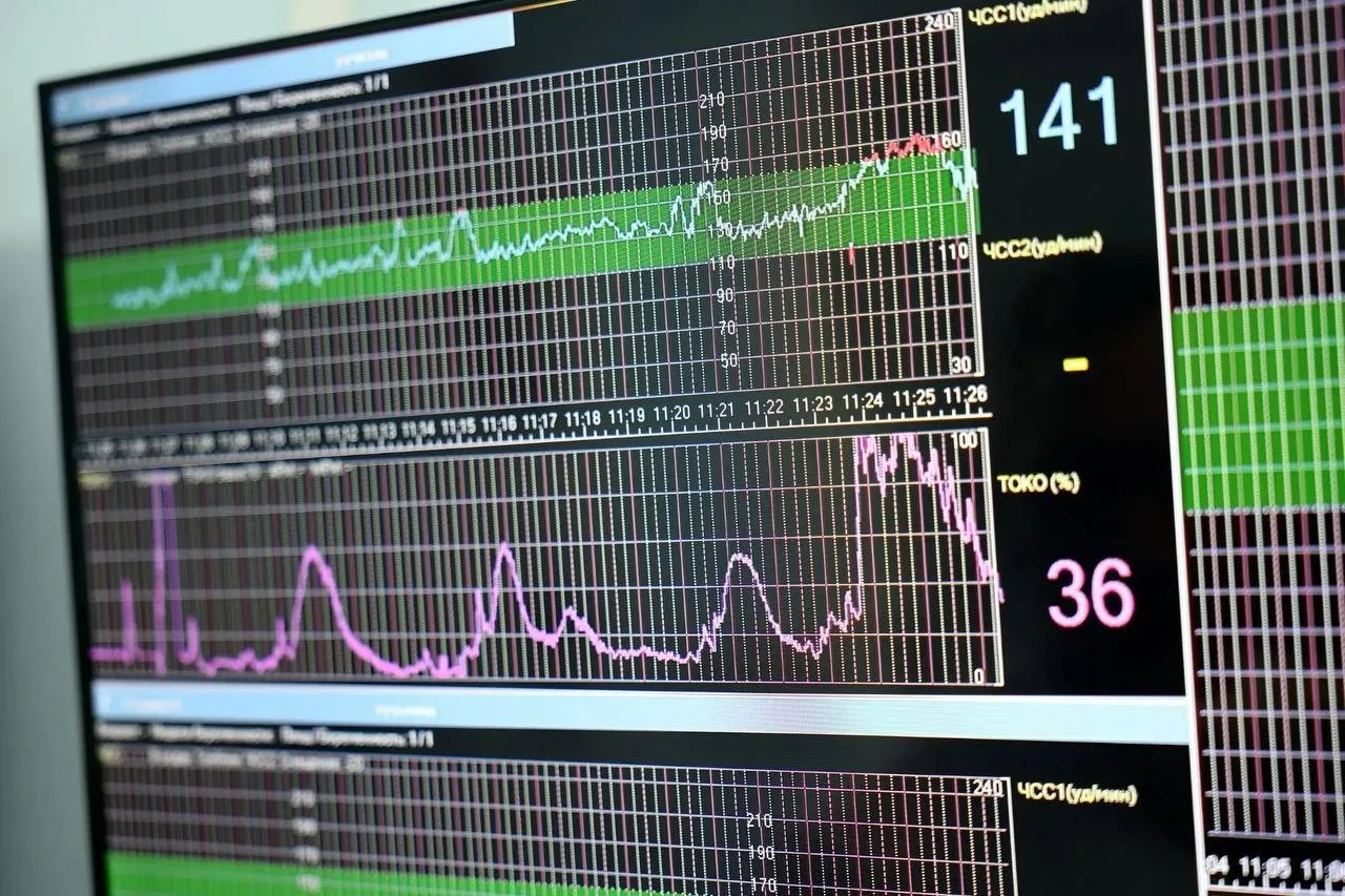🏥 В перинатальном центре имени Бакуниной установили систему мониторинга беременных и м...
