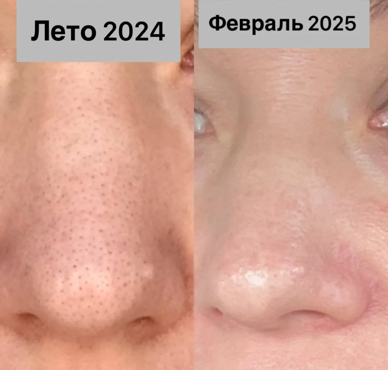 Посмотрите обязательно отзывы, это лучшие экспертные заключения🤗⬆️