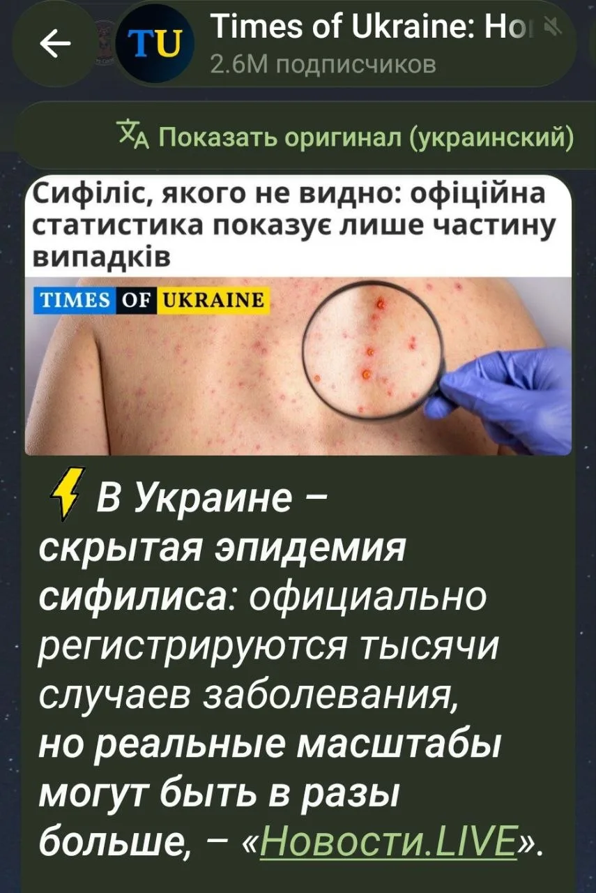 Медиа публикации