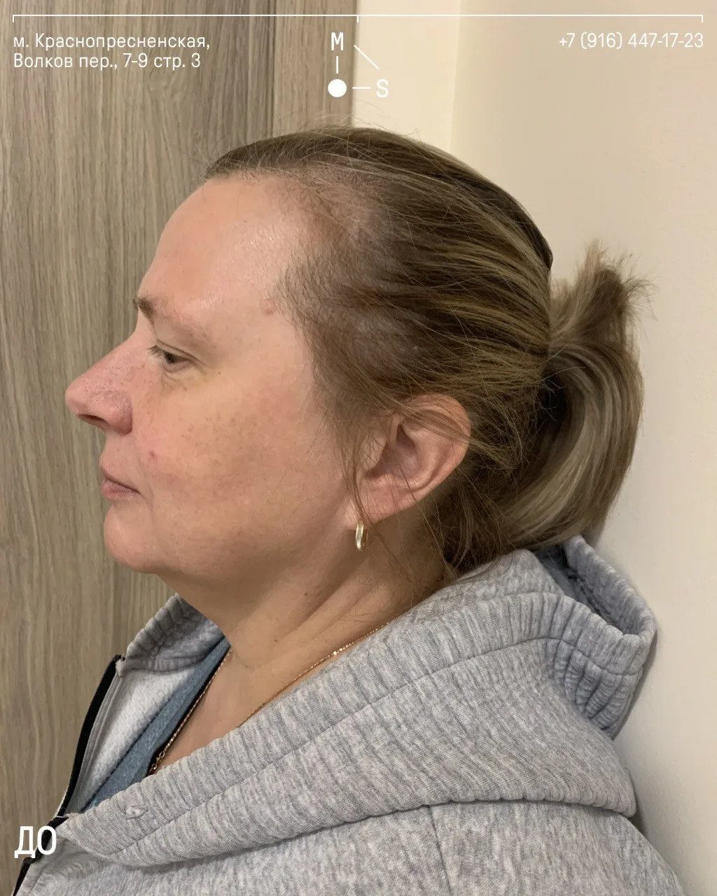 Решила стать моложе в 55 лет без пластических операций