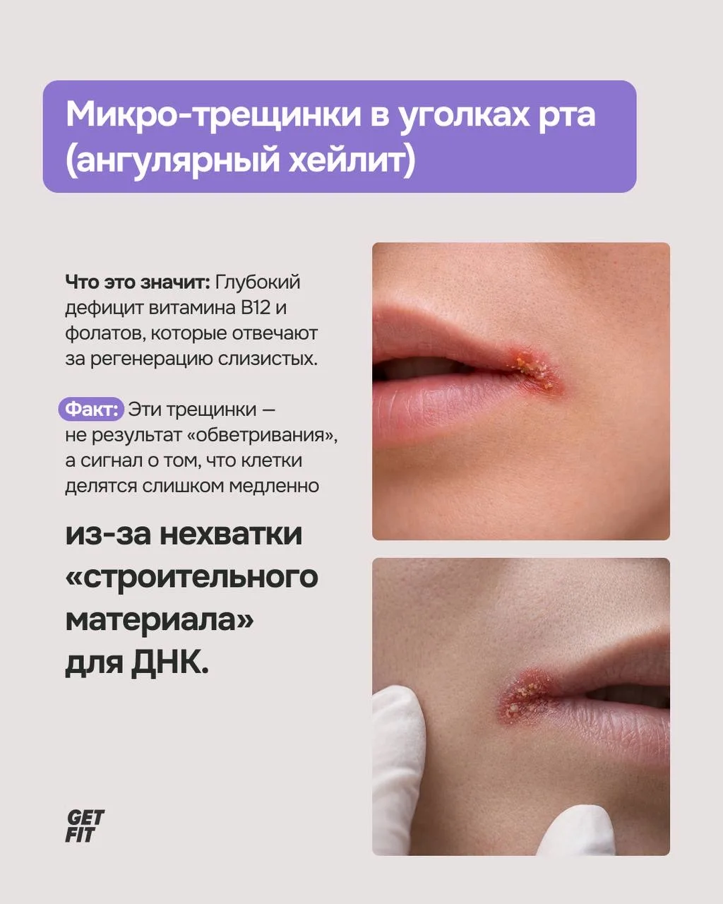 🤔 Мы привыкли думать, что морщины — это возраст, а ломкие ногти — плохой лак.   Но современная наука