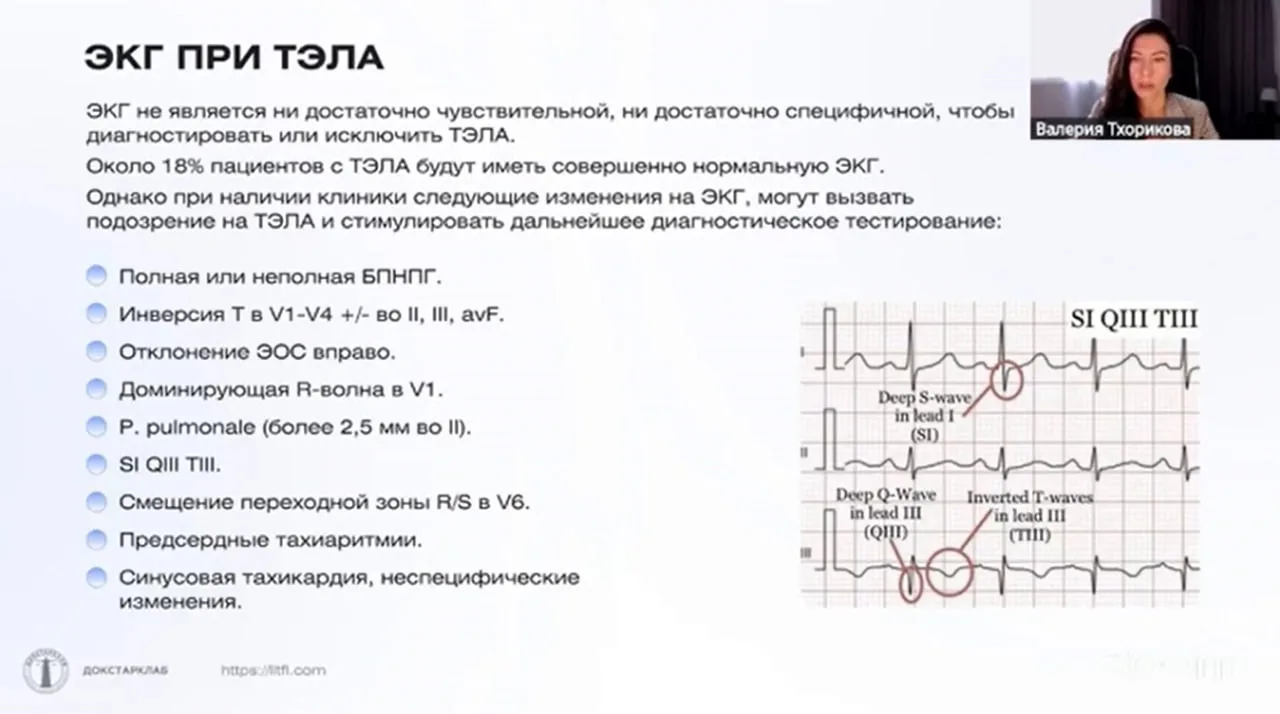 Коллеги разбираем ЭКГ при ТЭЛА!

Подключайтесь:

https://sozvezdie-edu.ru/web/fd_1606

Подарки, для 