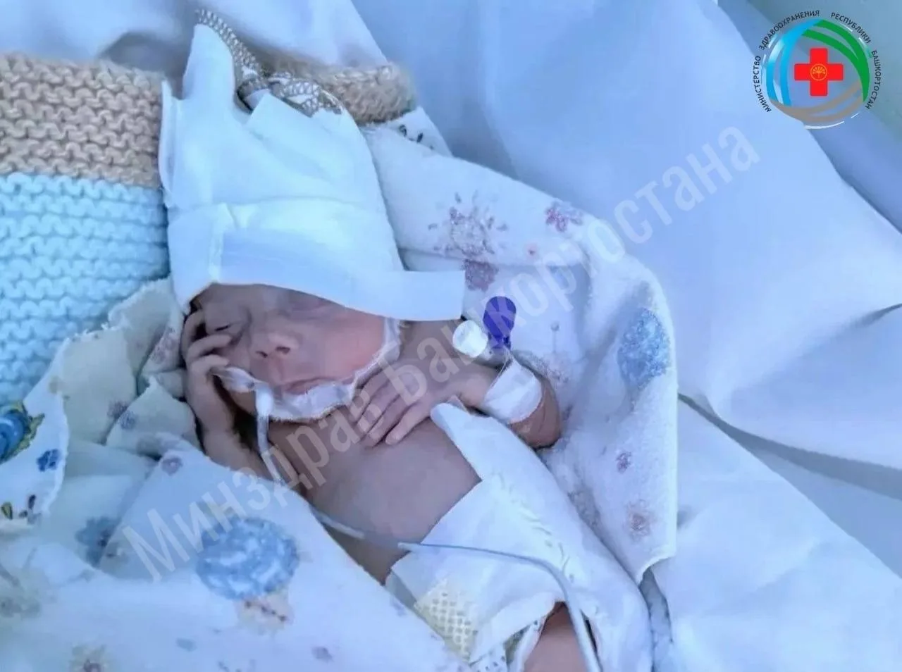 👶 В Башкирии выходили «Дюймовочку», которая родилась весом всего 650 граммов