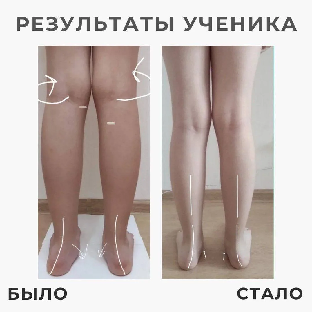 Просто посмотрите на РЕЗУЛЬТАТЫ НАШИХ УЧЕНИКОВ!🔥👆🏻  Мамы, которые перестали надеяться на то, что про