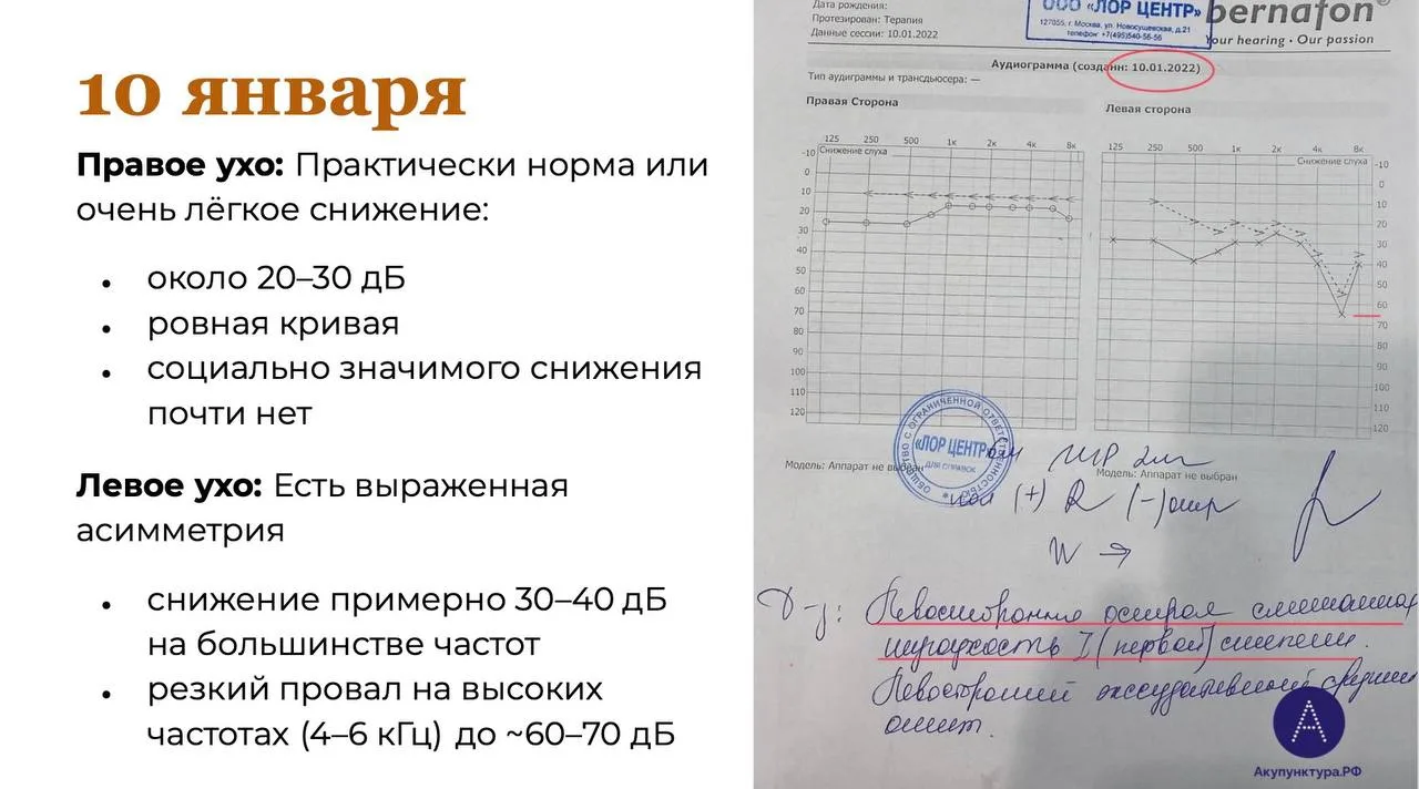 Клинический случай №2