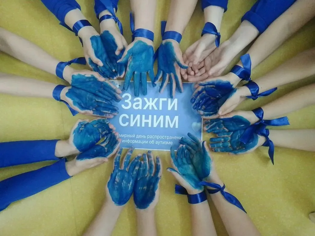 🔷️"ЗАЖГИ СИНИМ"🔵