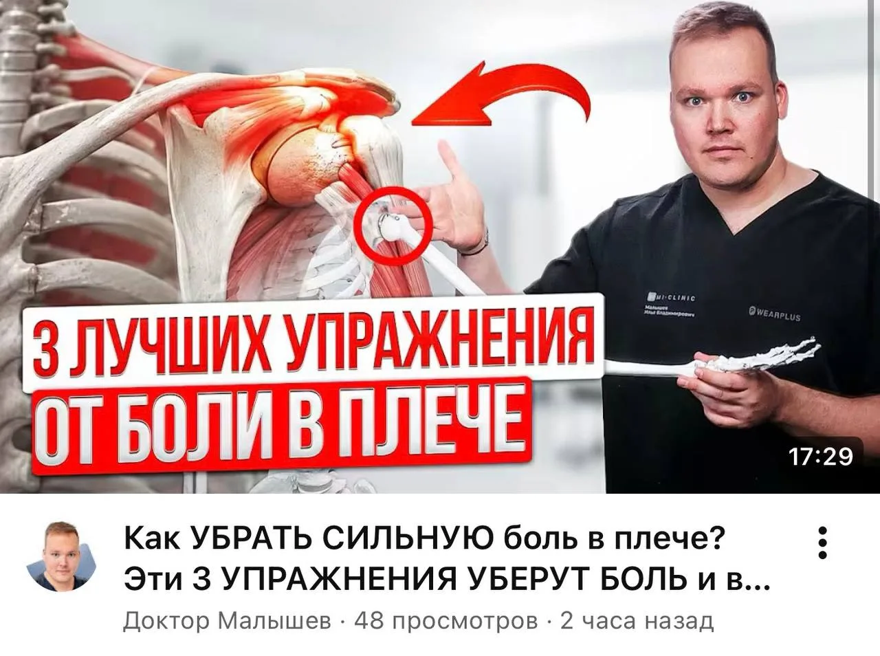 Многие просили снять видео про плечо - и я наконец снял.