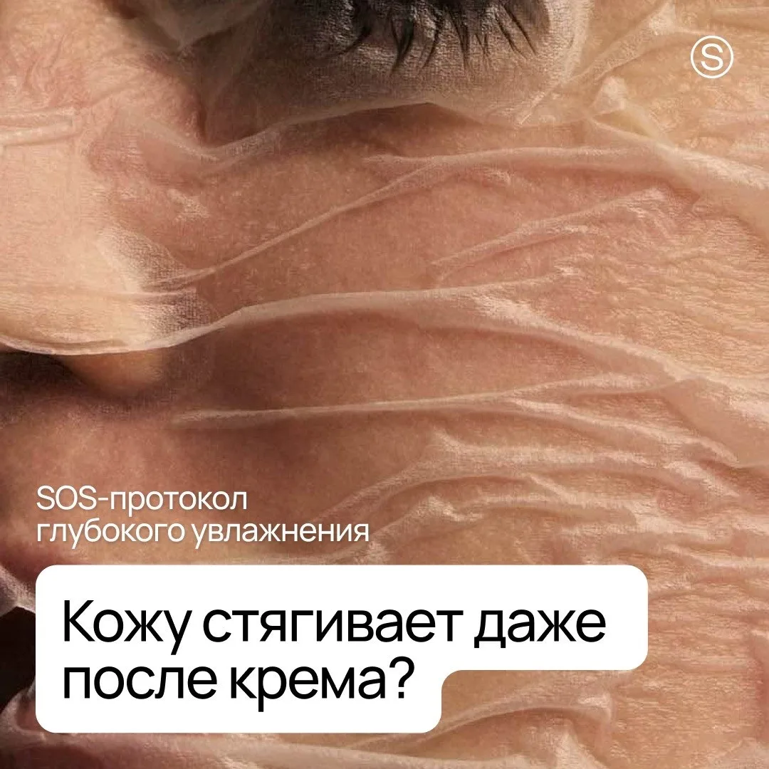 «Мажу кремом два раза в день — кожу всё равно стягивает».