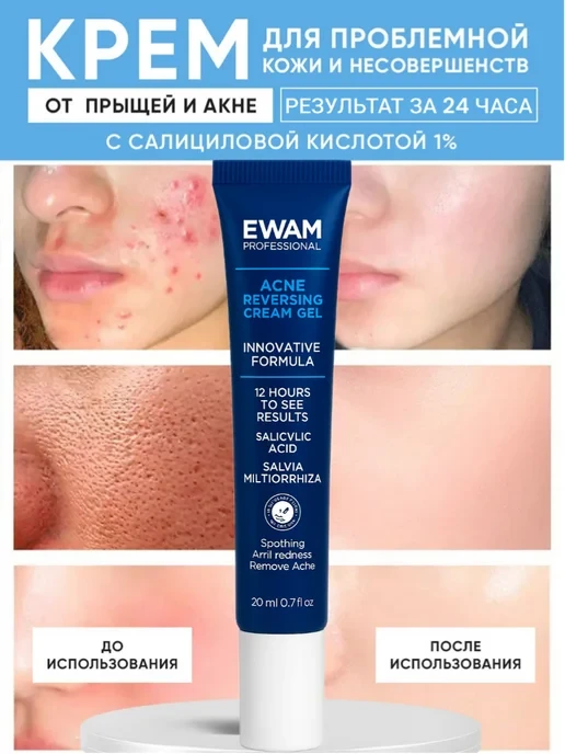 🛒 Крем от прыщей и акне на лице и теле 1%