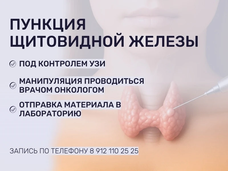 🔬 Пункция щитовидной железы под контролем УЗИ — безопасная и точная процедура!
