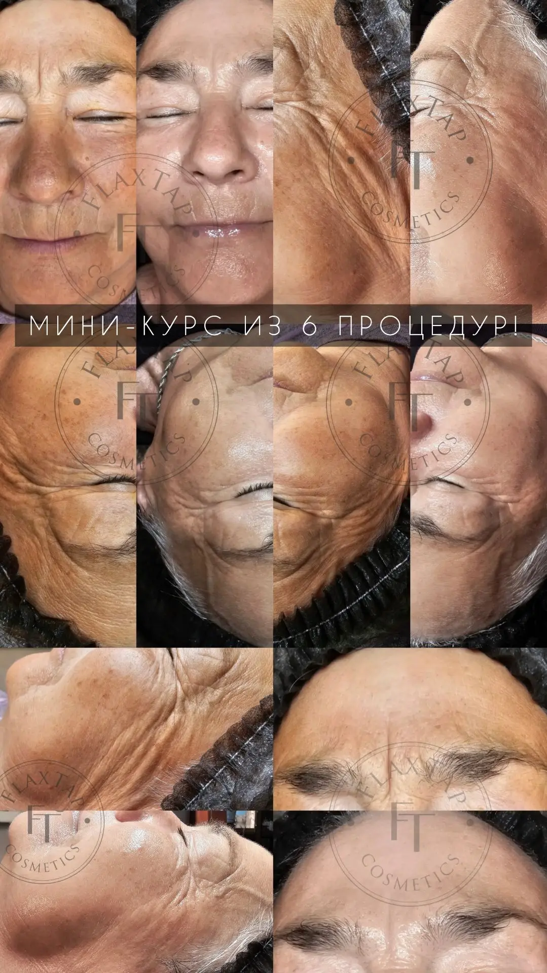 Приглашаю на омоложение ✨