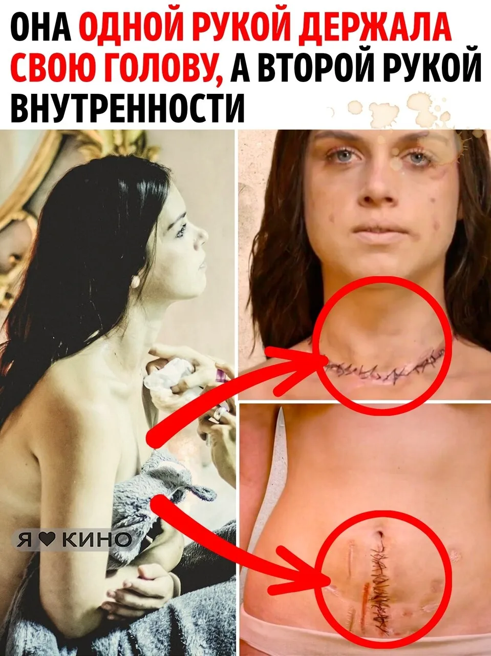 30 ножевых ранений, перерезанное горло и вспоротый живот. Она не только выжила — она за...