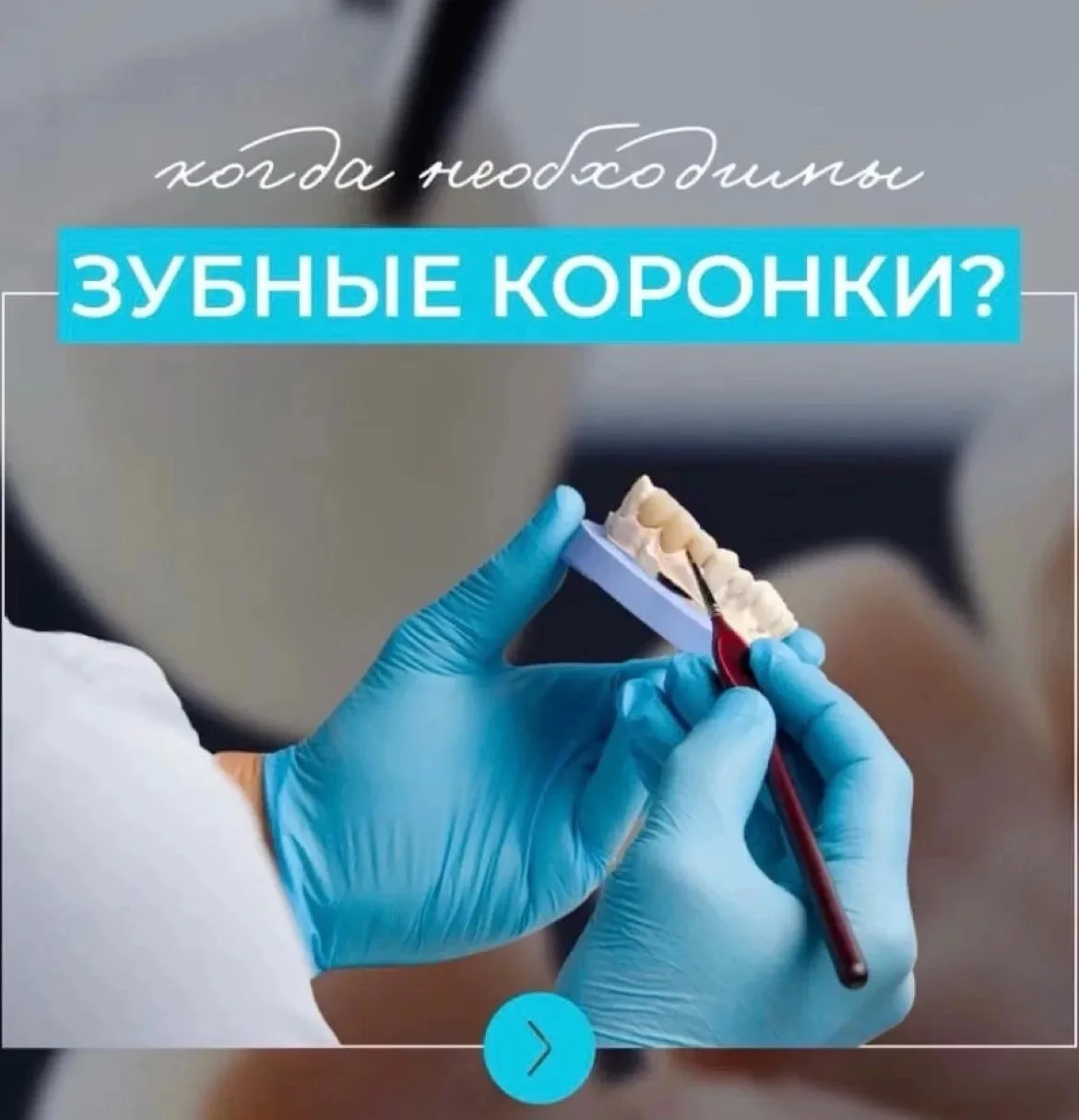 🦷 Когда необходимы зубные коронки?