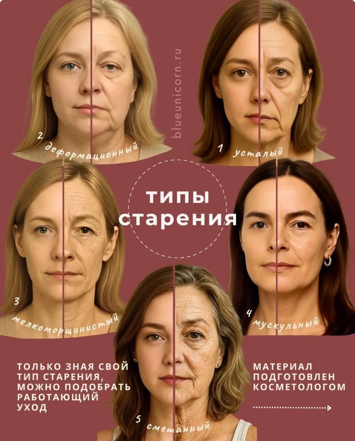 Вот основные типы старения, каждый из которых имеет свои характерные особенности: