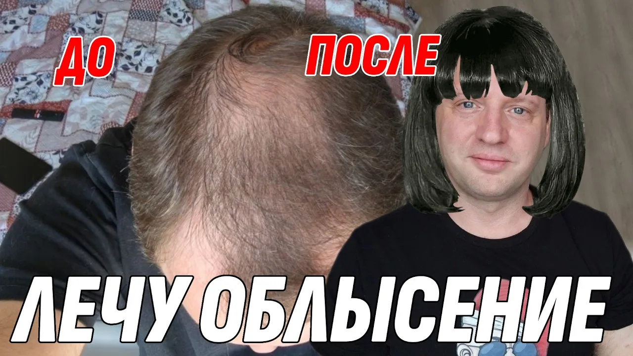 Новый влог уже вышел! Приятного просмотра, друзья 💝

Смотреть: https://rutube.ru/video/a8b02f4af331