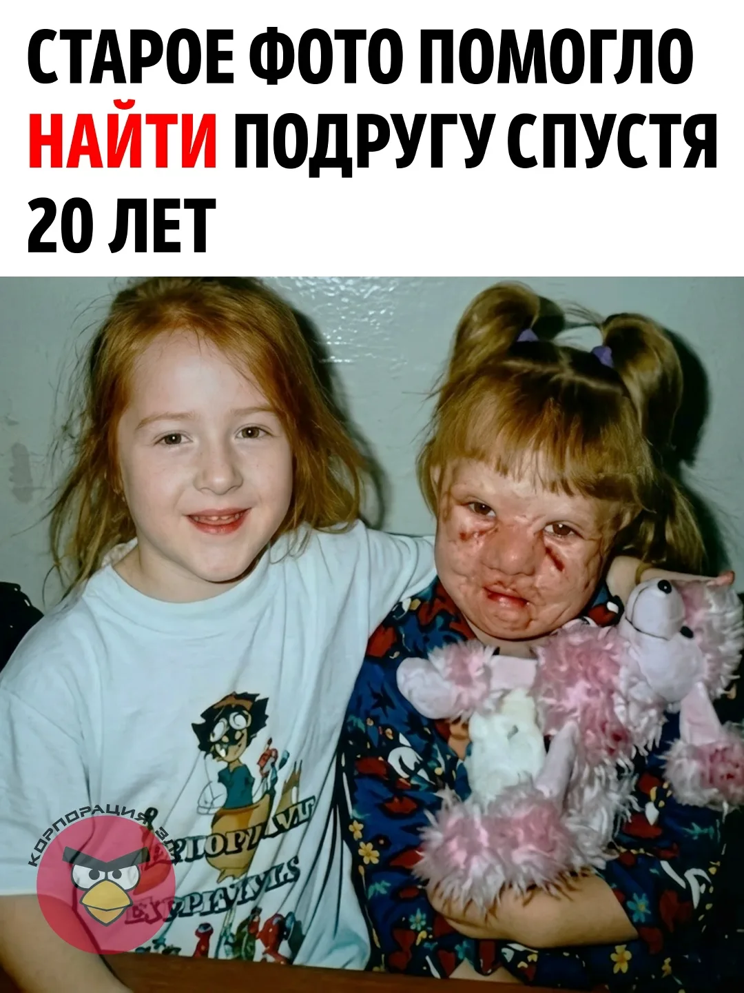 В четыре года Настя получила тяжёлые ожоги во время несчастного случая. Ей пришлось про...