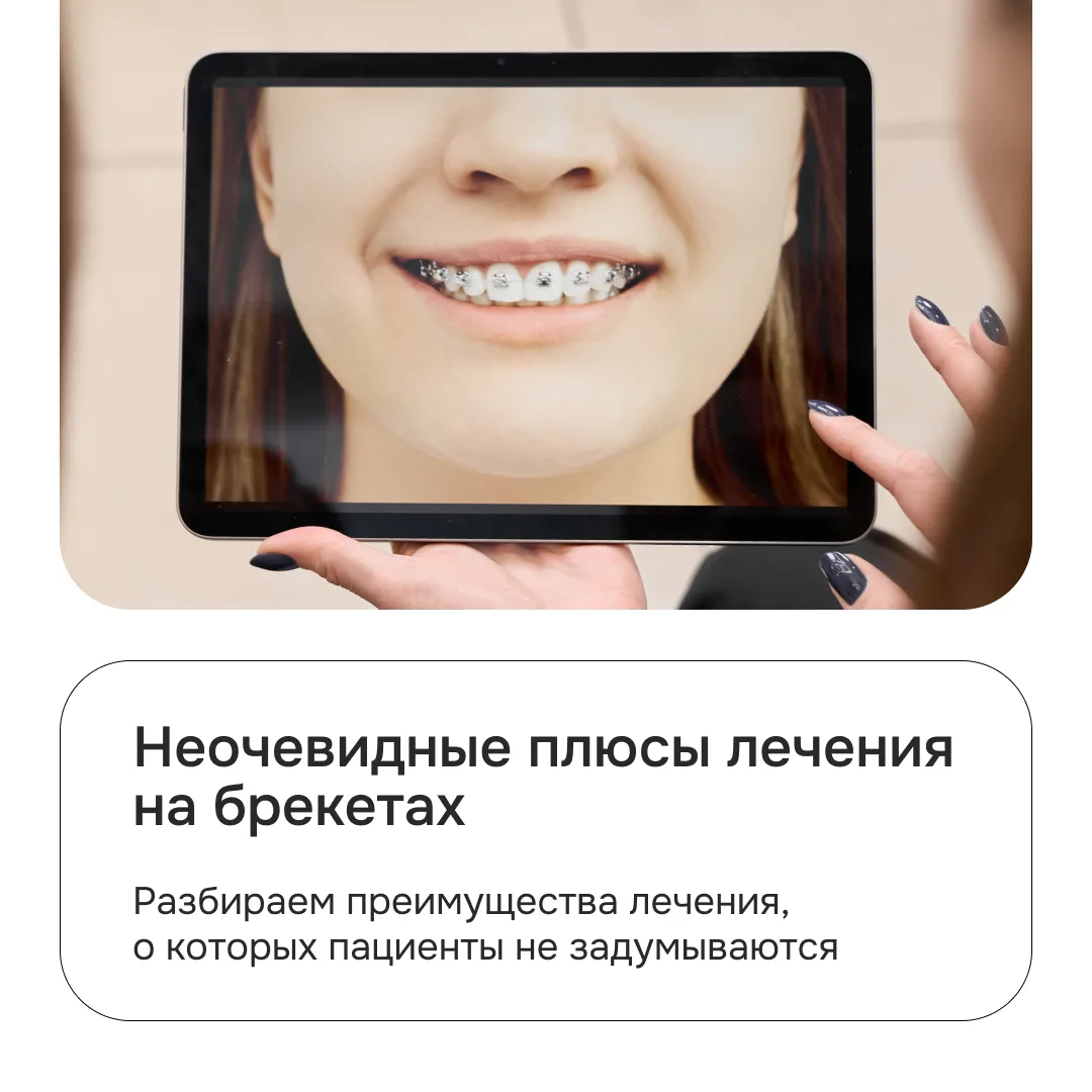 Лечение на брекетах выбирают не только за ровные зубы и красивую улыбку😍
