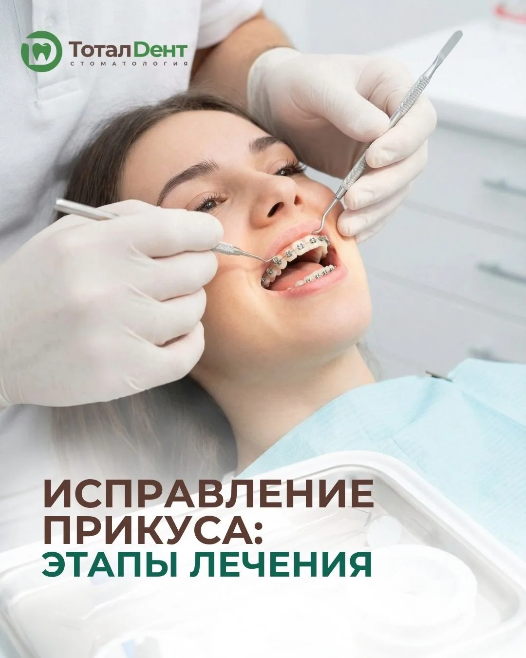 Ортодонтическое лечение – это не просто «поставить брекеты или элайнеры». Это путь, кот...