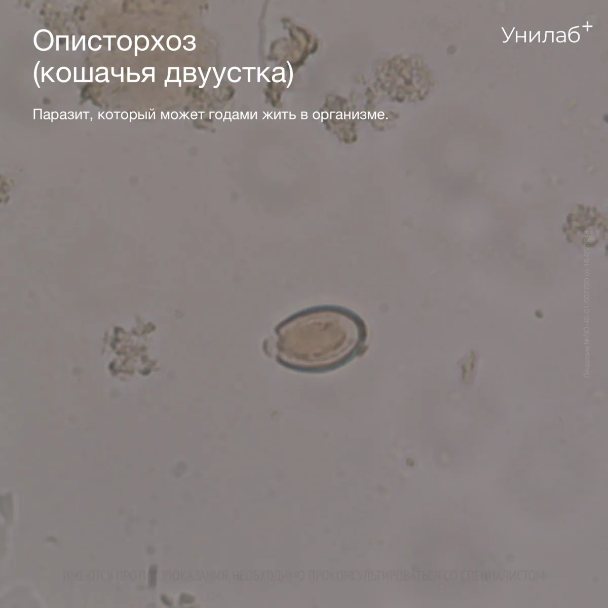 🪱 Описторхоз: паразит, который может годами жить в организме незаметно

Любите слабосолёную, вяле