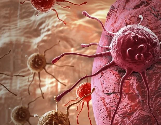 🔬 Чем больше случаев колоректального рака в семье, тем выше риск для пациентов с ВЗК
