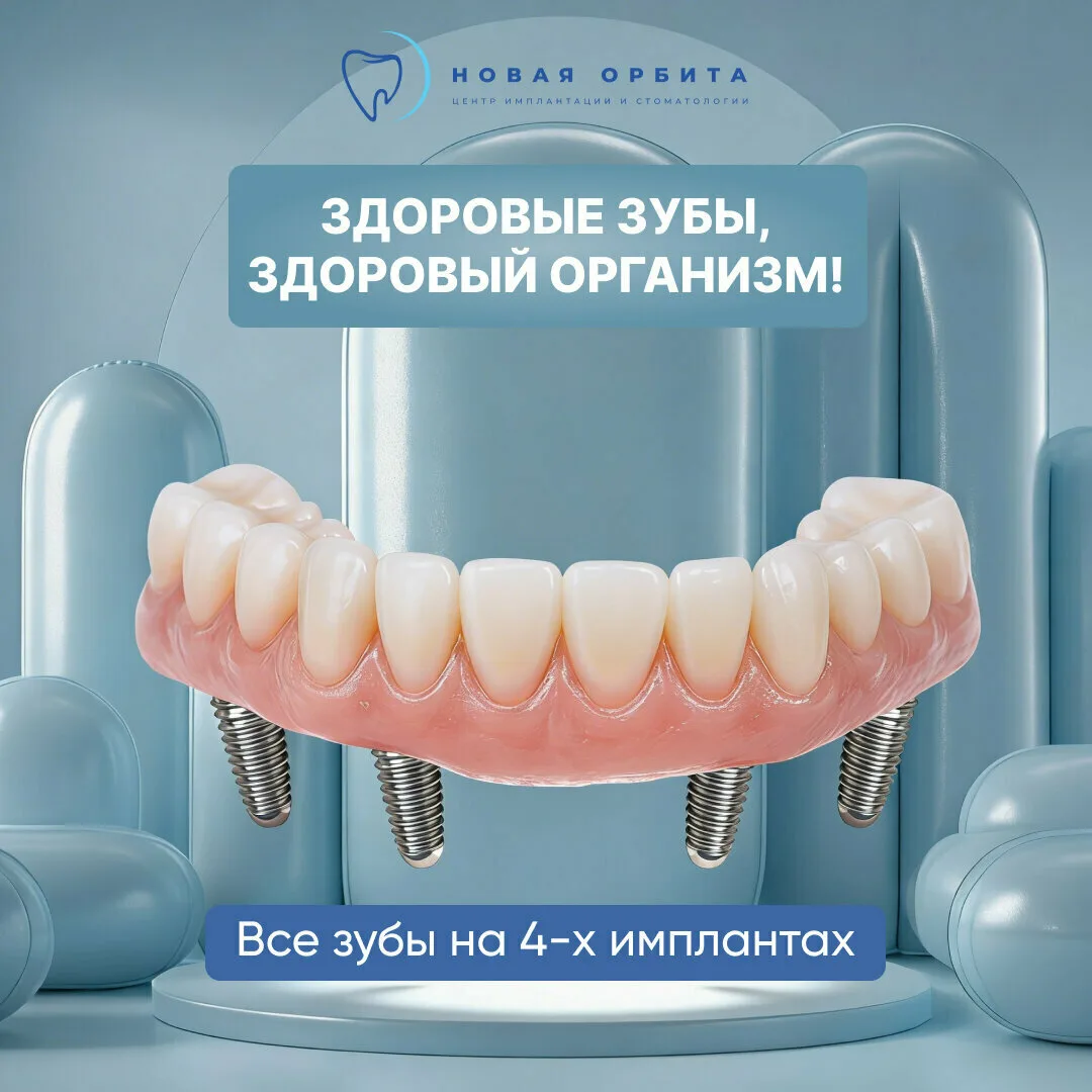 Сделаем зубы по акции «под ключ»: 4 импланта + протез!