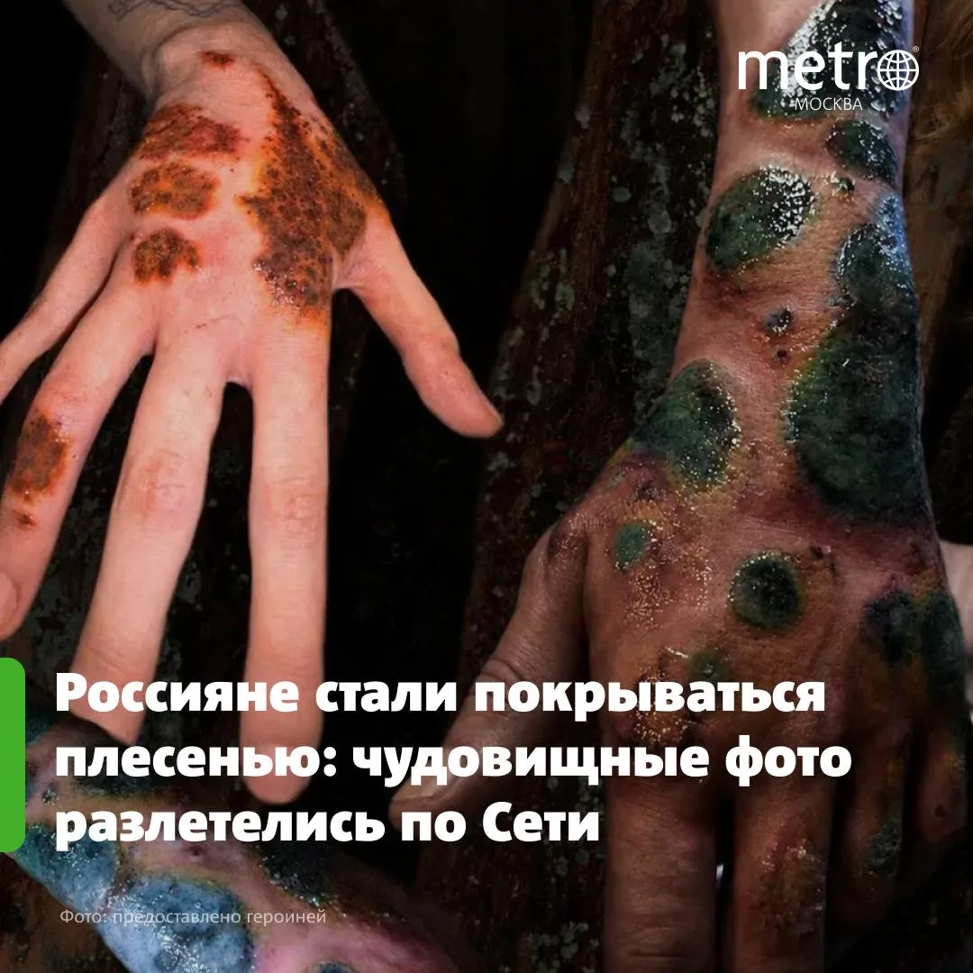 🫢 «Не думала, что это зайдёт»: тату-мастер из России наносит на кожу «плесень»