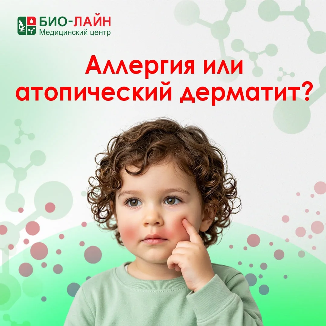 Аллергия или атопический дерматит?

Покраснение кожи, зуд, сухость или высыпания далеко не всегда оз