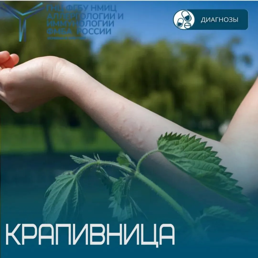 1 октября - Международный день крапивницы