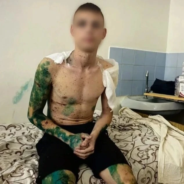 17-летний студент Старобельского колледжа Максим рассказал, как ему удалось выжить во в...