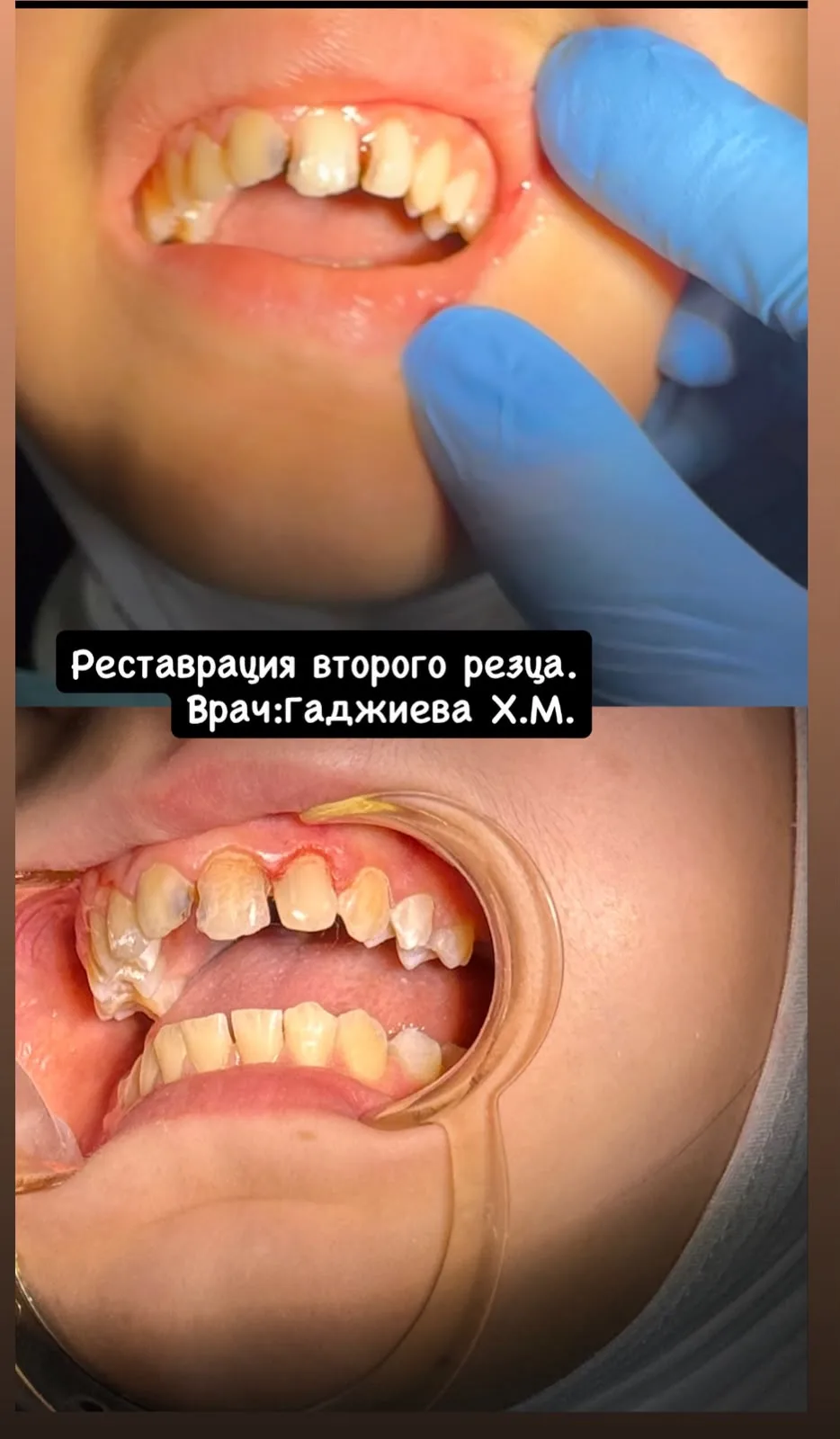 В Республиканской детской стоматологической поликлинике высококвалифицированные врачи п...