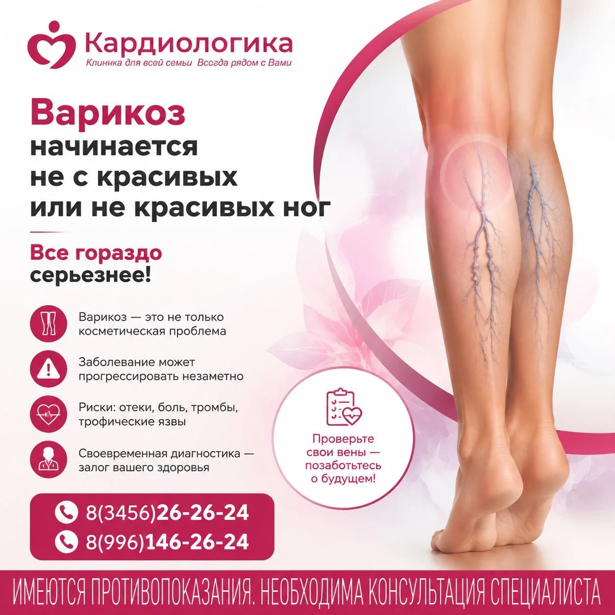 Варикоз начинается не с красивых или некрасивых ног.