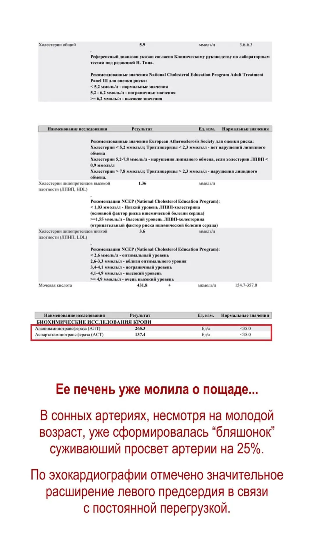 Вечерний кардиопривет♥️
