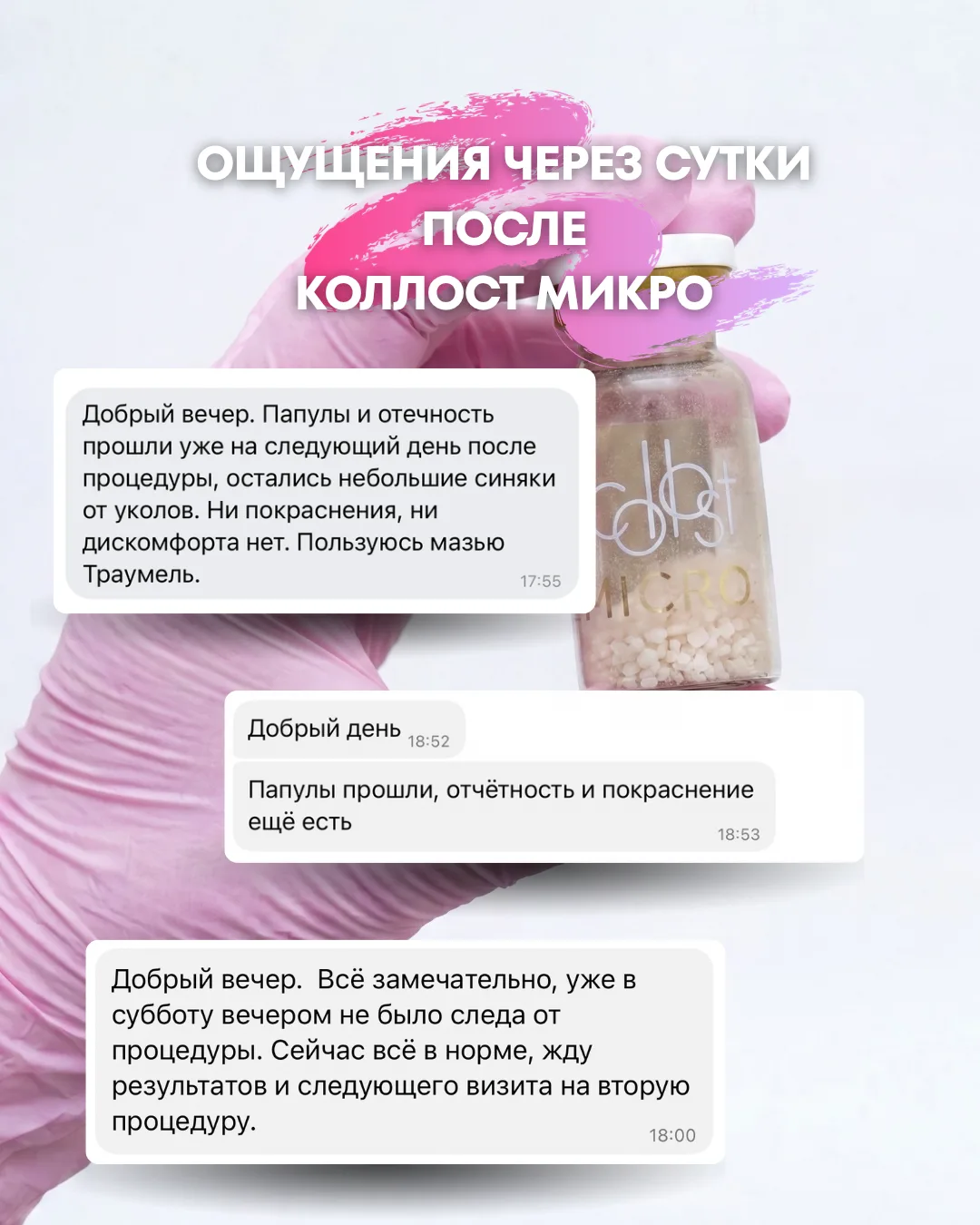 В отзывах можете прочитать какие ощущения у вас будут через сутки после Коллагенотерапии Коллост Мик